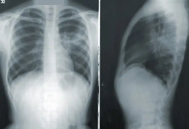 Radiological Imaging