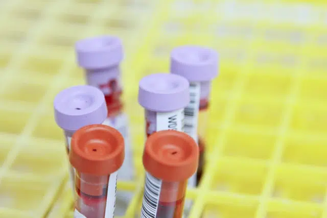 Blood tests