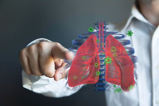 Understanding Pulmonary Conditions: Insights from Expert Consultants